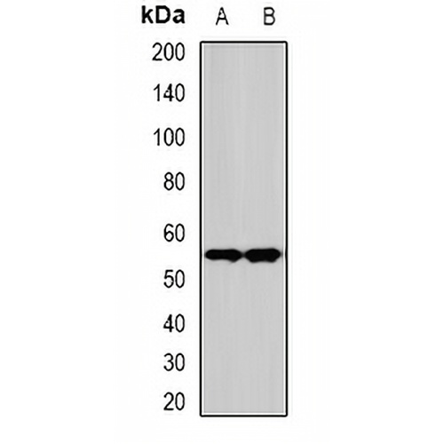 SPHK1 Rabbit Polyclonal Antibody