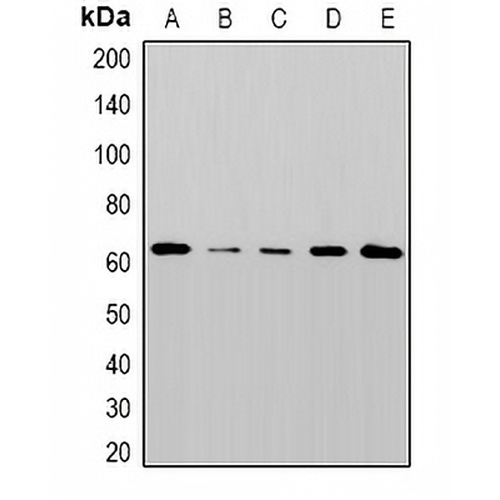 NDR1 Rabbit Polyclonal Antibody