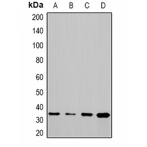 CHIP Rabbit Polyclonal Antibody