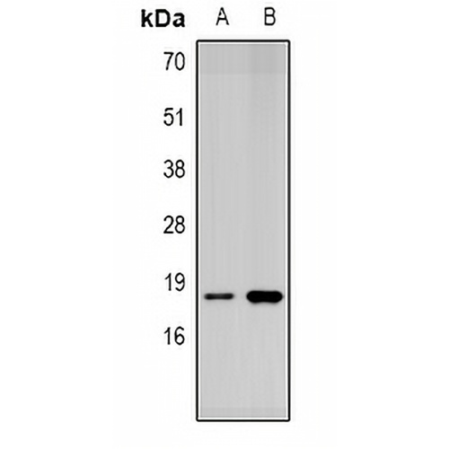 SUMO4 Rabbit Polyclonal Antibody