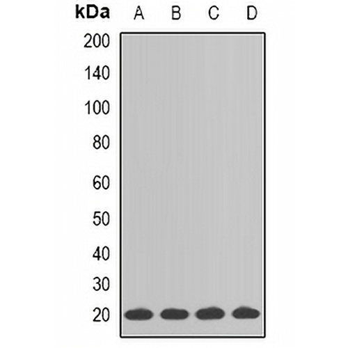SM22 alpha Rabbit Polyclonal Antibody