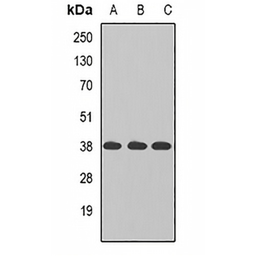 TAMM41 Rabbit Polyclonal Antibody