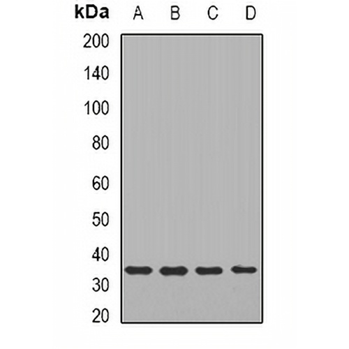 TIRAP Rabbit Polyclonal Antibody