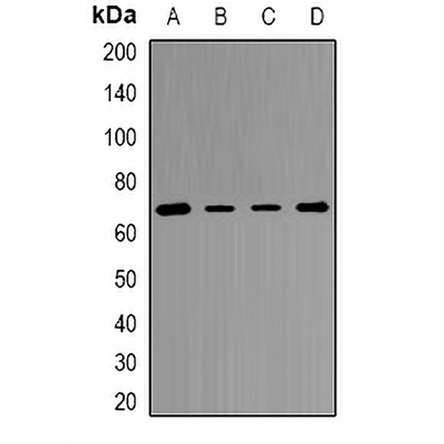 Transketolase Rabbit Polyclonal Antibody