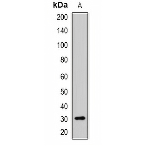 HVEM Rabbit Polyclonal Antibody