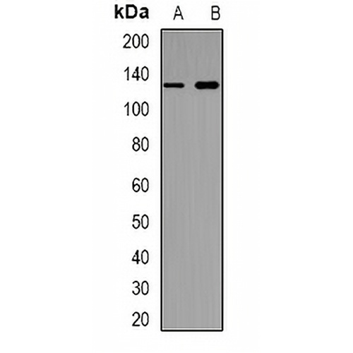 CD30 Rabbit Polyclonal Antibody
