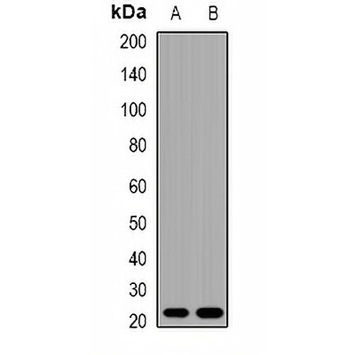 TNNI2 Rabbit Polyclonal Antibody