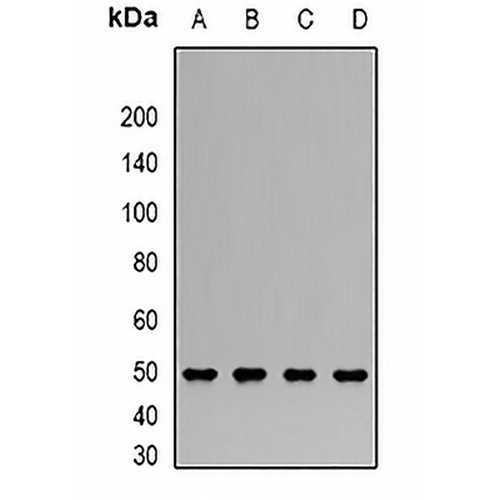 CLN2 Rabbit Polyclonal Antibody