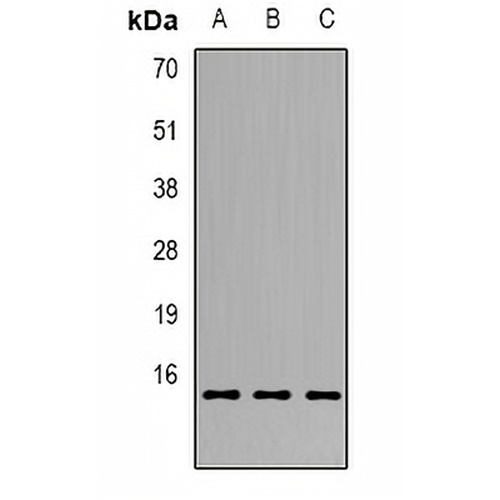 GILZ Rabbit Polyclonal Antibody