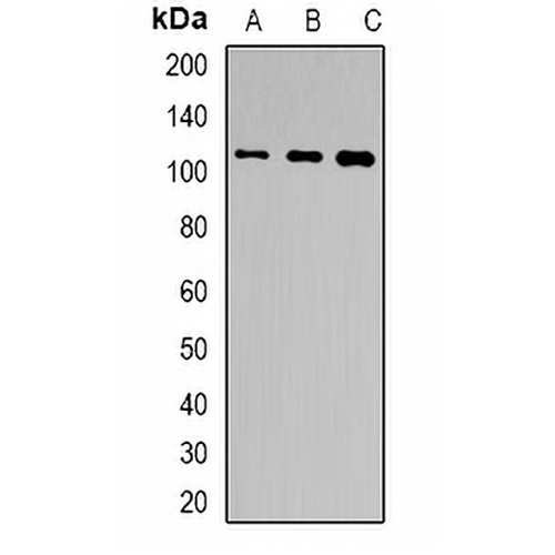 TSHR Rabbit Polyclonal Antibody