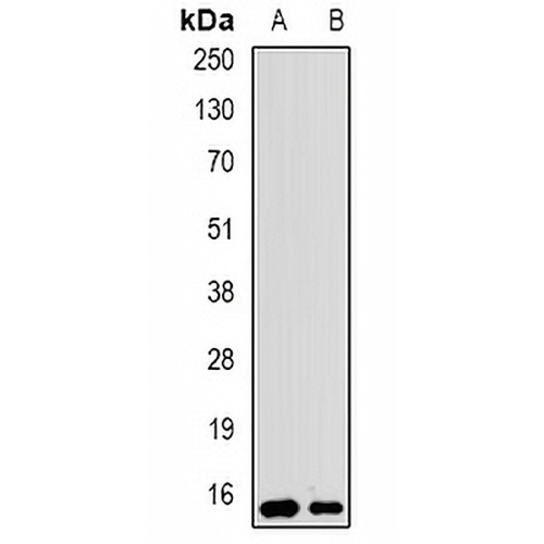 UBCH5 Rabbit Polyclonal Antibody