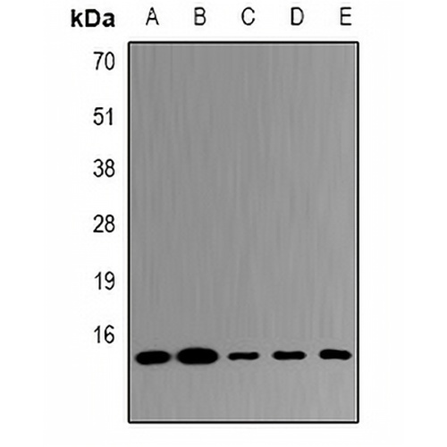 UBE2D4 Rabbit Polyclonal Antibody