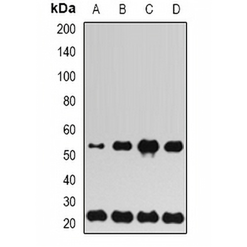 UBE2H Rabbit Polyclonal Antibody