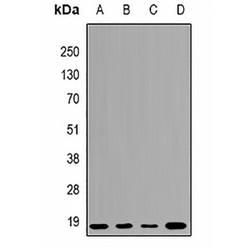 UBCH7 Rabbit Polyclonal Antibody