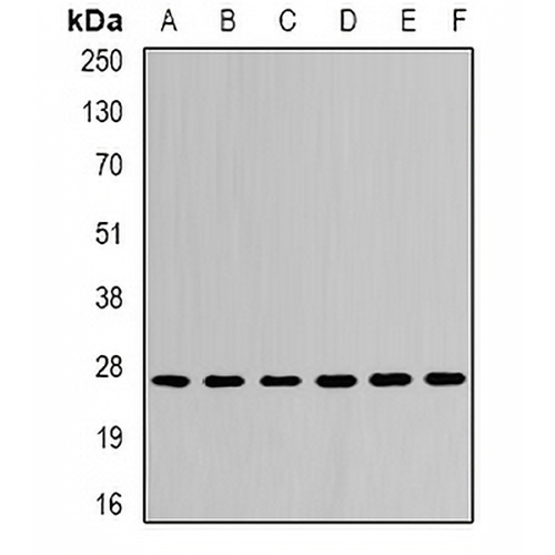 CDC34B Rabbit Polyclonal Antibody