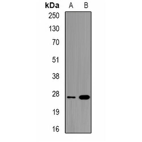 ULBP2 Rabbit Polyclonal Antibody