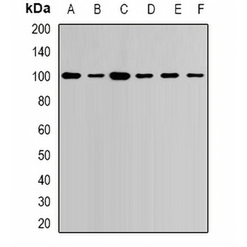 USP16 Rabbit Polyclonal Antibody
