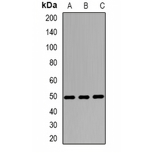 Wilms Tumor 1 Rabbit Polyclonal Antibody