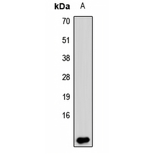S100-B Rabbit Polyclonal Antibody