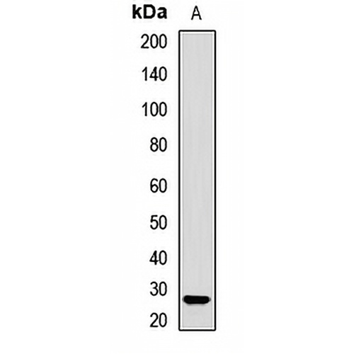 SMNDC1 Rabbit Polyclonal Antibody