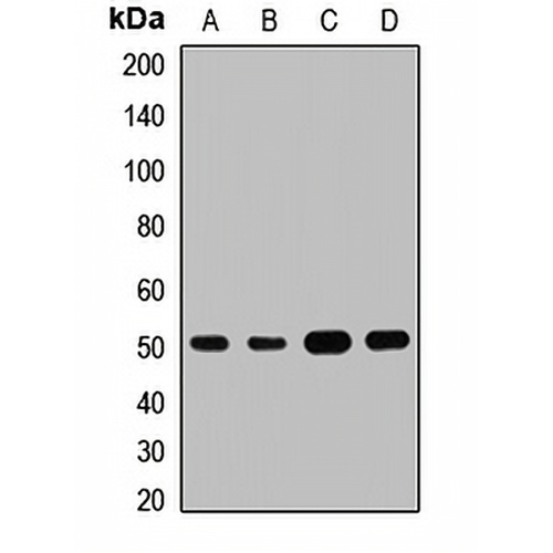 ILK Rabbit Polyclonal Antibody