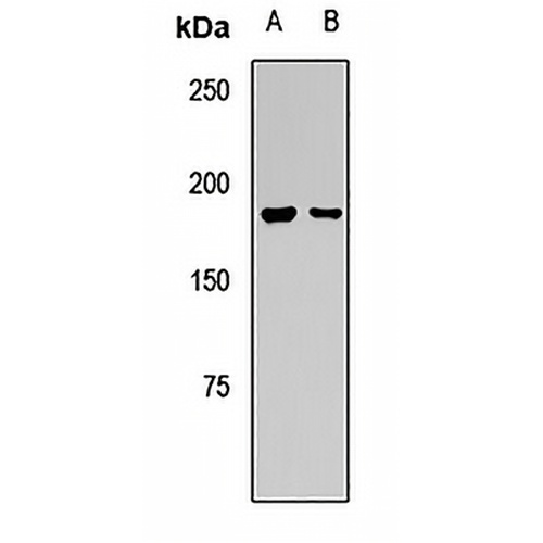 NMDAR2A Rabbit Polyclonal Antibody