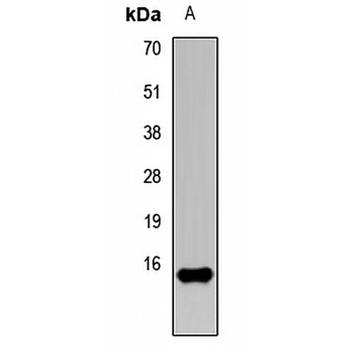 FABP5 Rabbit Polyclonal Antibody
