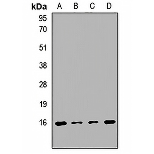 PPP3R1 Rabbit Polyclonal Antibody