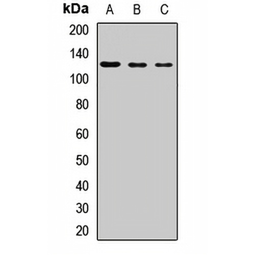 PI3K p110 beta Rabbit Polyclonal Antibody