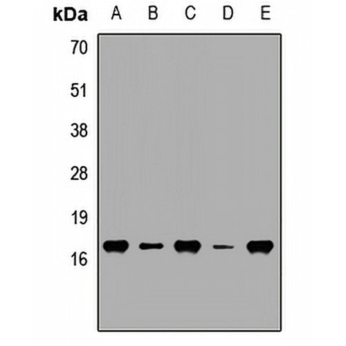 VILIP-3 Rabbit Polyclonal Antibody