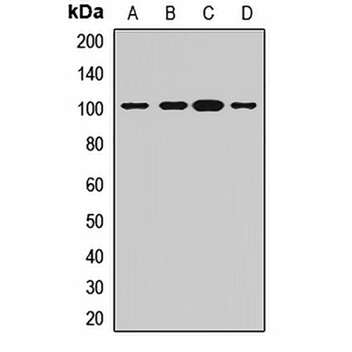 ADAM22 Rabbit Polyclonal Antibody