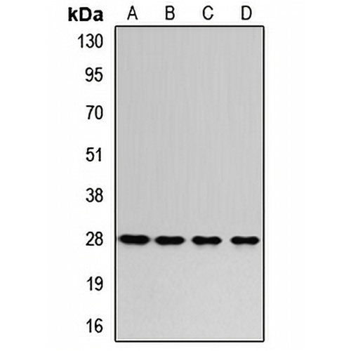 RPL8 Rabbit Polyclonal Antibody