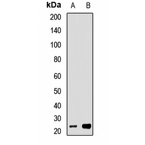Tim23 Rabbit Polyclonal Antibody