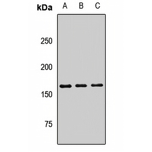 PLA2R Rabbit Polyclonal Antibody