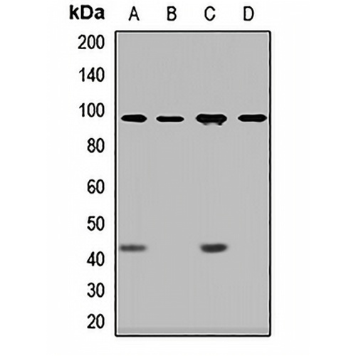 Dystroglycan Rabbit Polyclonal Antibody