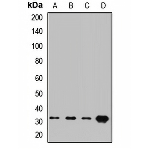 ATP4B Rabbit Polyclonal Antibody