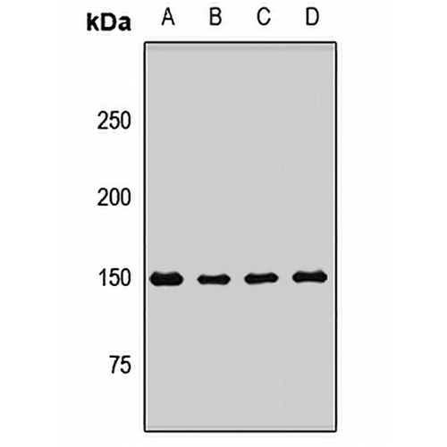 IKAP Rabbit Polyclonal Antibody