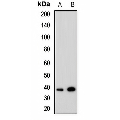 TRIB1 Rabbit Polyclonal Antibody
