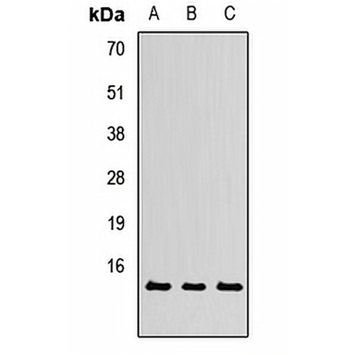 TXNL4A Rabbit Polyclonal Antibody