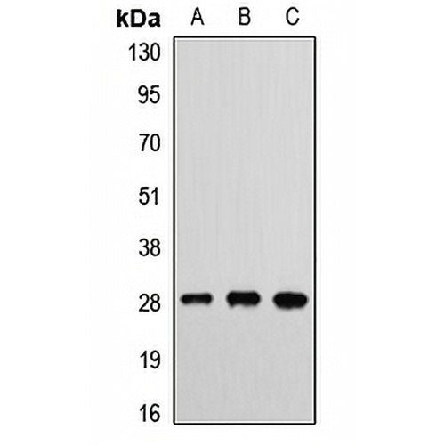 ETHE1 Rabbit Polyclonal Antibody