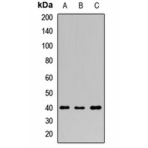 PDX1 Rabbit Polyclonal Antibody