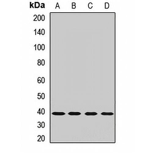 Glycogenin-1 Rabbit Polyclonal Antibody