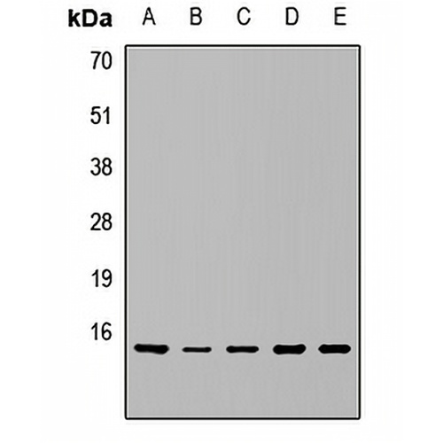 RPS15A Rabbit Polyclonal Antibody