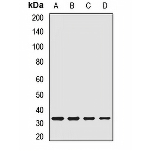 CTP Rabbit Polyclonal Antibody