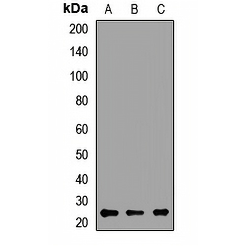 TPD52 Rabbit Polyclonal Antibody