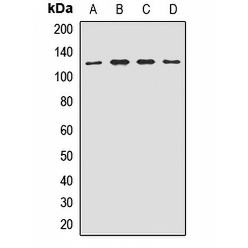 EIF3B Rabbit Polyclonal Antibody