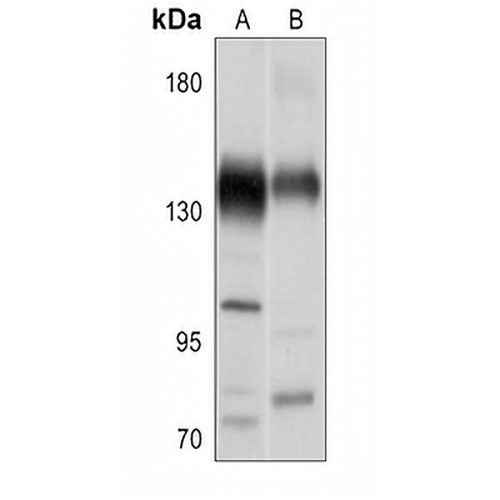 CACNA2D2 Rabbit Polyclonal Antibody