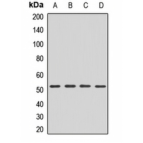 FADS2 Rabbit Polyclonal Antibody