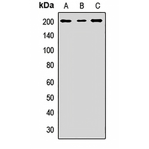 NCOA2 Rabbit Polyclonal Antibody