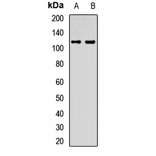 EMC1 Rabbit Polyclonal Antibody